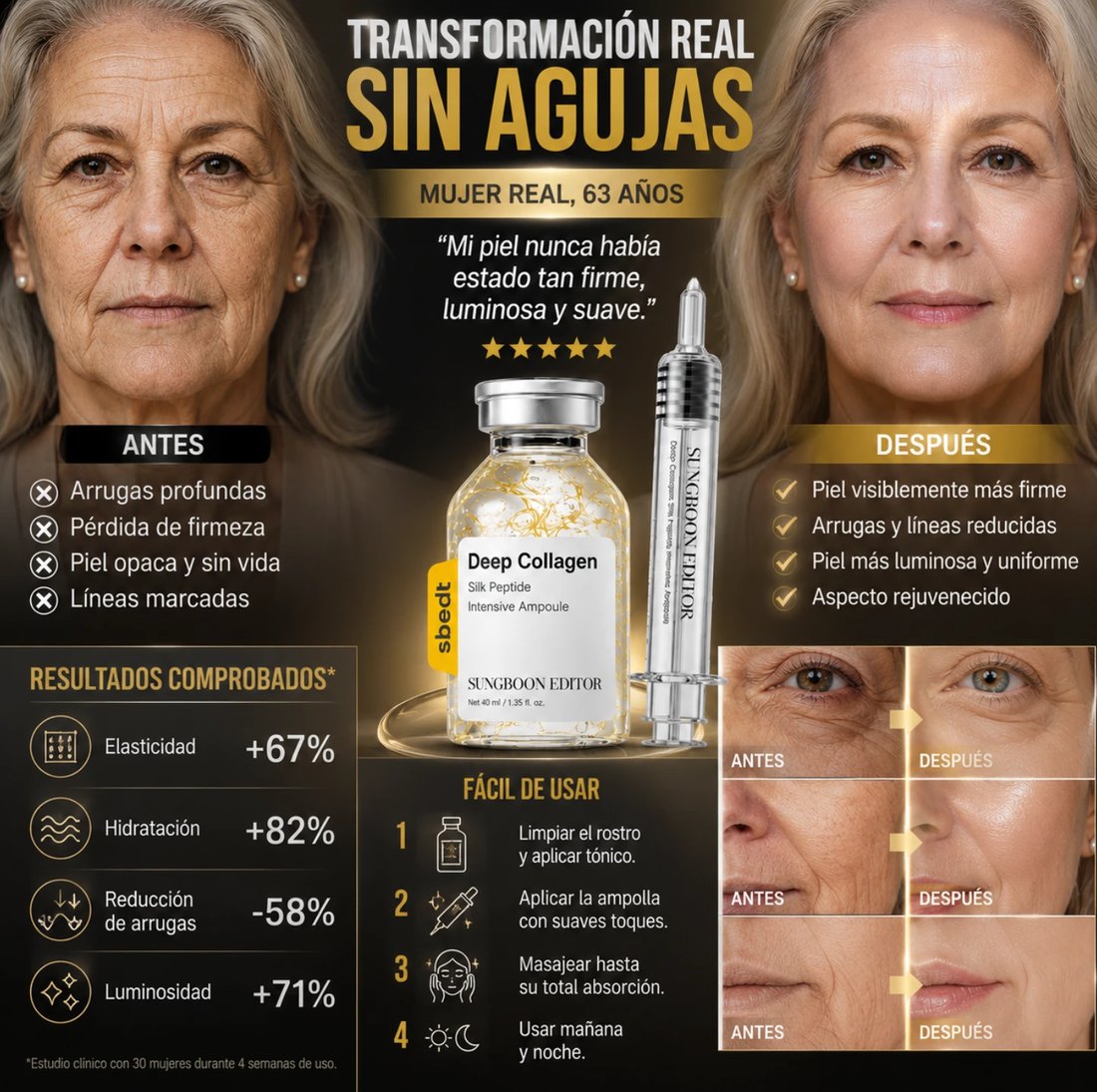 Transformación real sin agujas — resultados